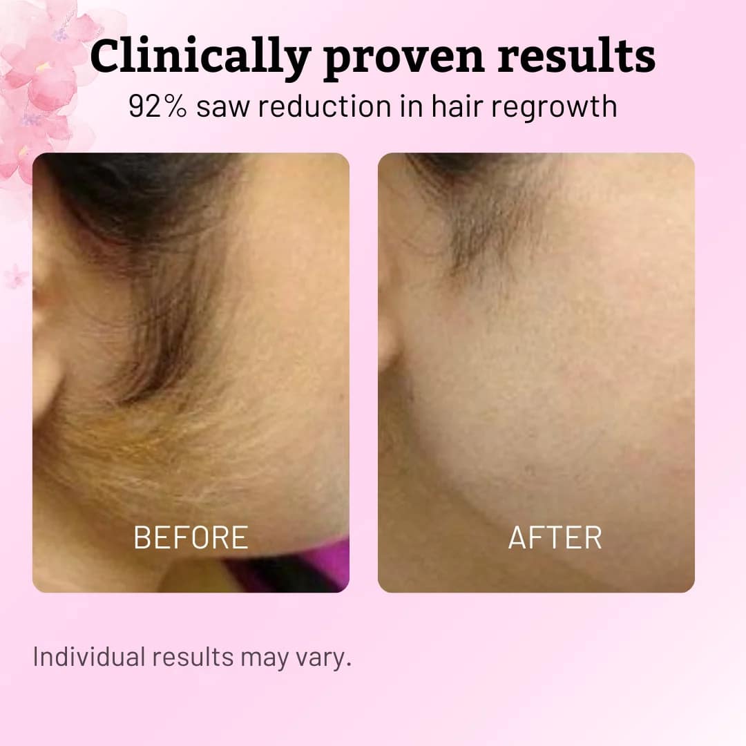 Cyperus Rotundus Oil 60ml - Natural Hair Removal Formula Reduce Body Hair Growth - Image 3
