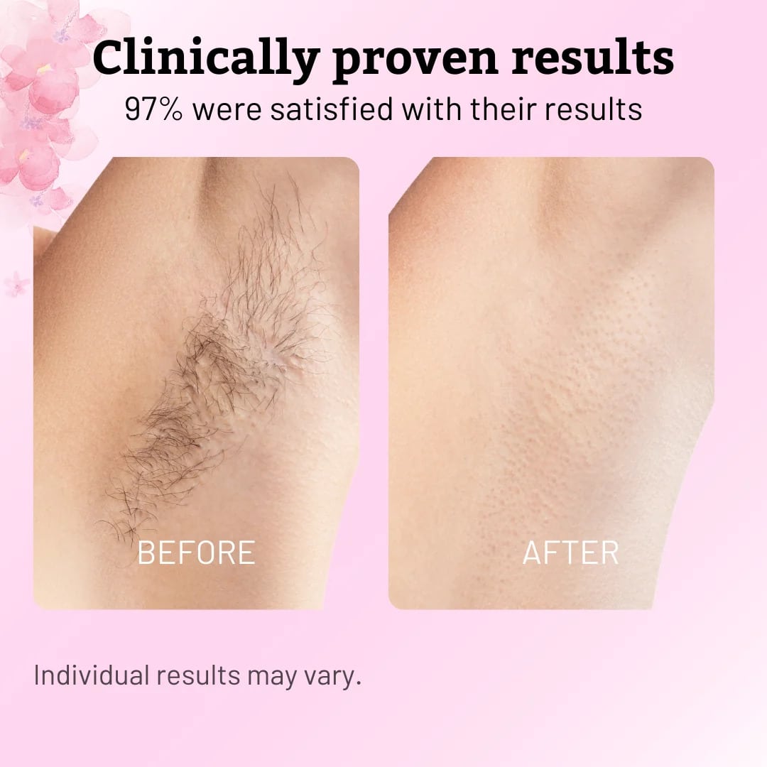 Cyperus Rotundus Oil 60ml - Natural Hair Removal Formula Reduce Body Hair Growth - Image 4